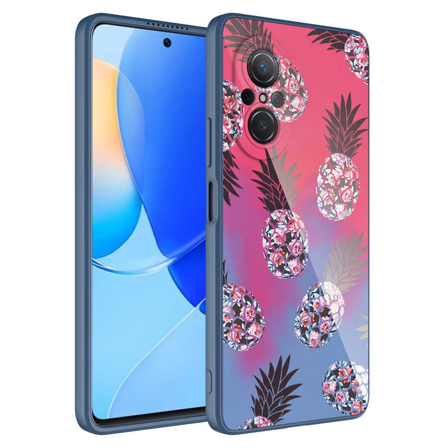 Huawei Nova 9 SE Kılıf Kamera Korumalı Desenli Sert Silikon NXXA Epoksi Kapak-NO3