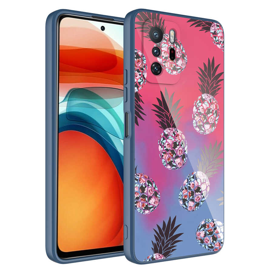 Xiaomi Redmi Note 10 Pro Kılıf Kamera Korumalı Desenli Sert Silikon NXXA Epoksi Kapak-NO3