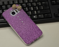 Galaxy S7 Edge Case Zore Fiyonklu Silicon - Zore