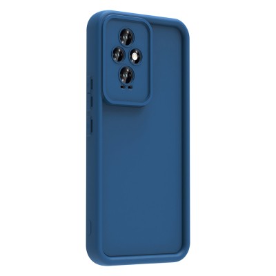 Honor 200 Case Camera Protection Zore Ananas Cover - 6