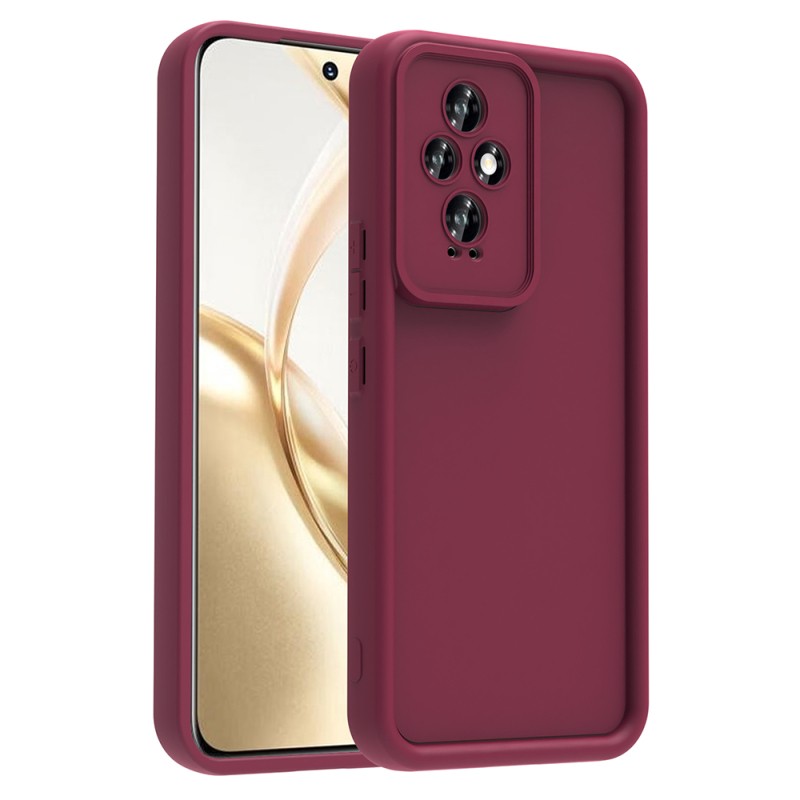 Honor 200 Kılıf Kamera Korumalı Zore Ananas Kapak - 3