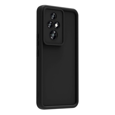 Honor 200 Pro Case Camera Protection Zore Ananas Cover - 6