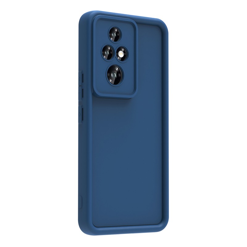 Honor 200 Pro Case Camera Protection Zore Ananas Cover - 10