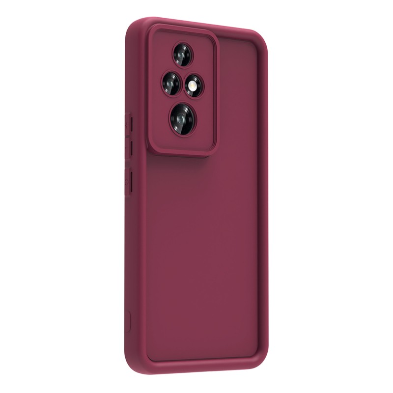 Honor 200 Pro Case Camera Protection Zore Ananas Cover - 12