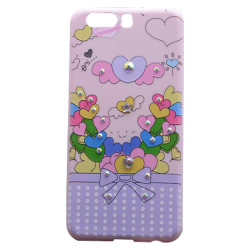 Huawei P10 Plus Kılıf Zore Pembiş Silikon - Zore