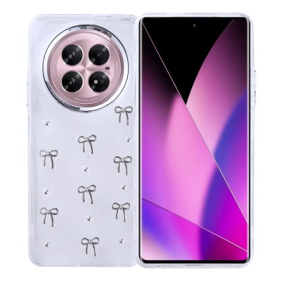 Infinix Zero 40 5G Case Airbag Design Glitter Transparent Zore Kutup Cover - 4