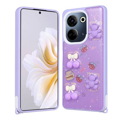 Tecno Camon 20 Pro 4G Case Shining Glitter Relief Figured Zore Cevze Cover - Zore