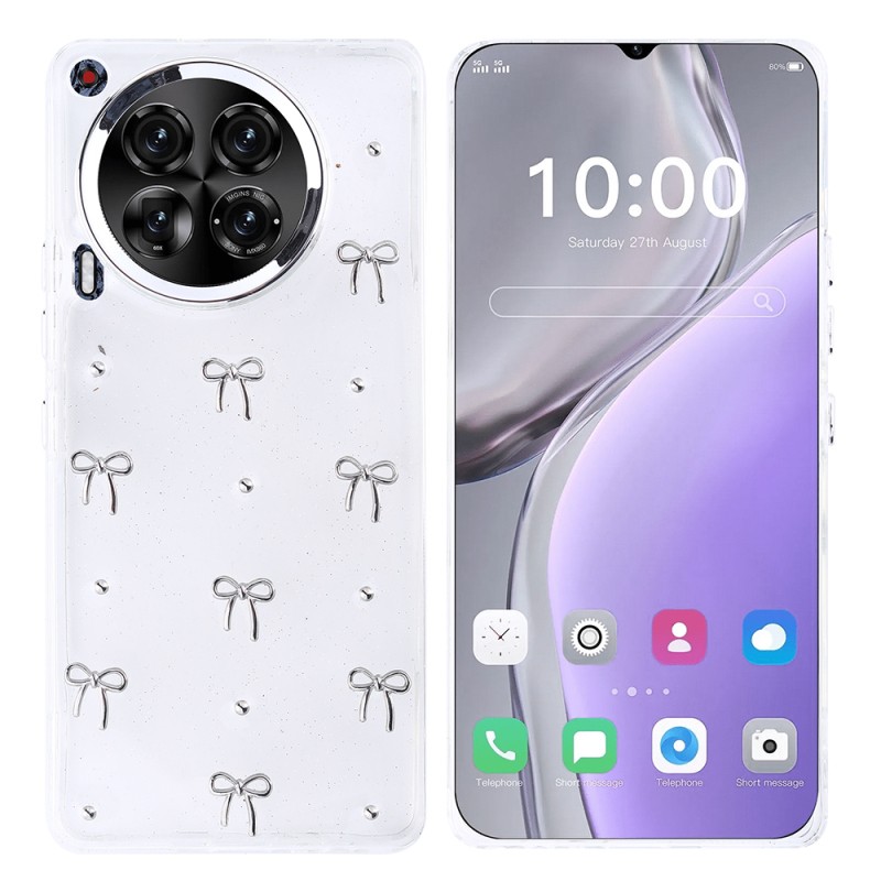 Tecno Camon 30 Case Airbag Design Glitter Transparent Zore Kutup Cover - 1