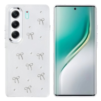Tecno Camon 40 4G Kılıf Airbag Tasarımlı Simli Şeffaf Zore Kutup Kapak - 3
