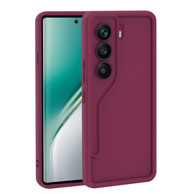 Tecno Camon 40 Pro Case Camera Protector Zore Ananas Cover - 3