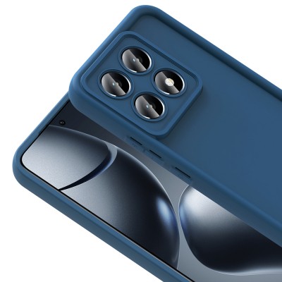 Xiaomi 14T Case Camera Protection Zore Ananas Cover - 8