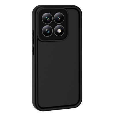 Xiaomi 15T Case with Camera Protection Zore Ananas Cover - 7