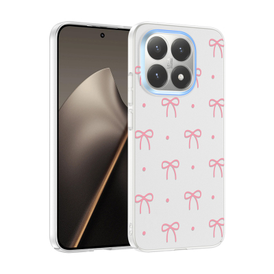 Xiaomi 15T Case with Camera Protector, Patterned Zore Clip Cover - Zore