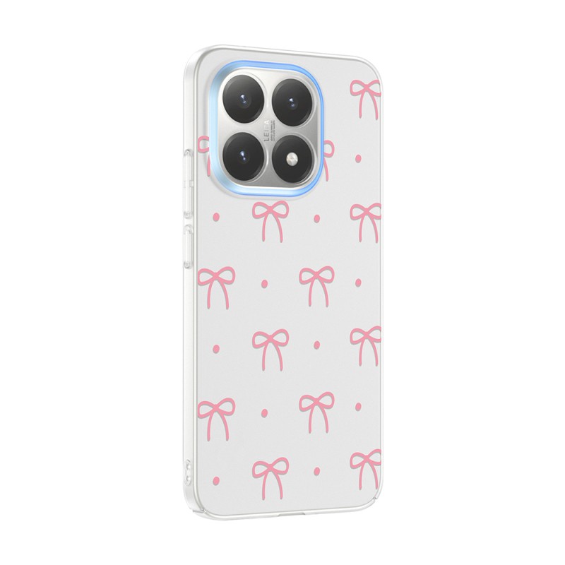 Xiaomi 15T Case with Camera Protector, Patterned Zore Clip Cover - 5