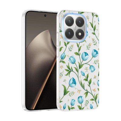 Xiaomi 15T Case with Camera Protector, Patterned Zore Clip Cover - 2