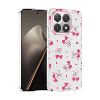Xiaomi 15T Case with Camera Protector, Patterned Zore Clip Cover - 3