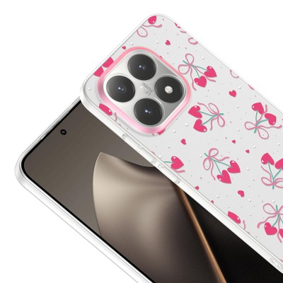 Xiaomi 15T Case with Camera Protector, Patterned Zore Clip Cover - 11