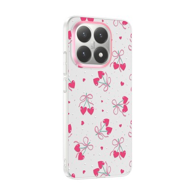 Xiaomi 15T Case with Camera Protector, Patterned Zore Clip Cover - 7