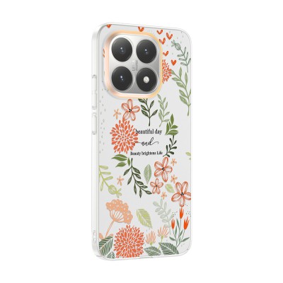 Xiaomi 15T Case with Camera Protector, Patterned Zore Clip Cover - 8