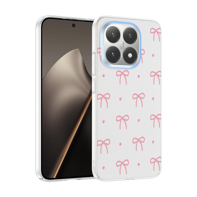 Xiaomi 15T Kılıf Kamera Korumalı Desenli Zore Klip Kapak - 1