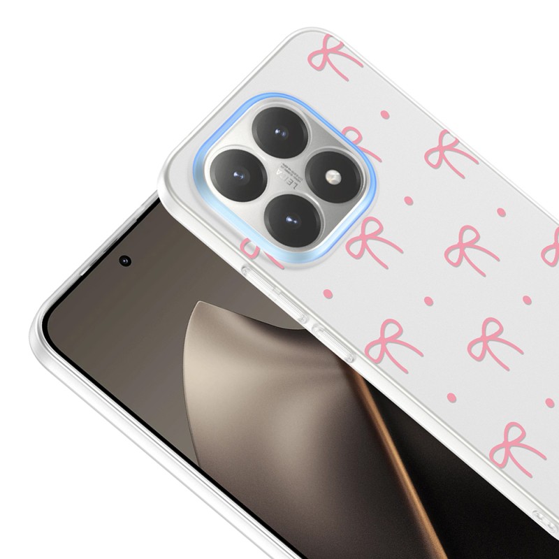 Xiaomi 15T Kılıf Kamera Korumalı Desenli Zore Klip Kapak - 9