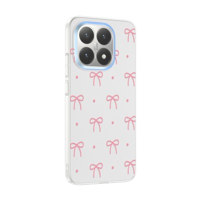 Xiaomi 15T Kılıf Kamera Korumalı Desenli Zore Klip Kapak - 5