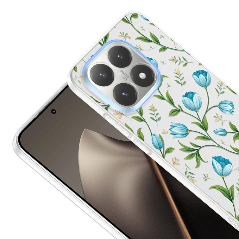 Xiaomi 15T Kılıf Kamera Korumalı Desenli Zore Klip Kapak - 10