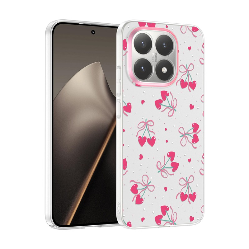 Xiaomi 15T Kılıf Kamera Korumalı Desenli Zore Klip Kapak - 3