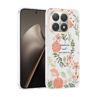 Xiaomi 15T Kılıf Kamera Korumalı Desenli Zore Klip Kapak - 4