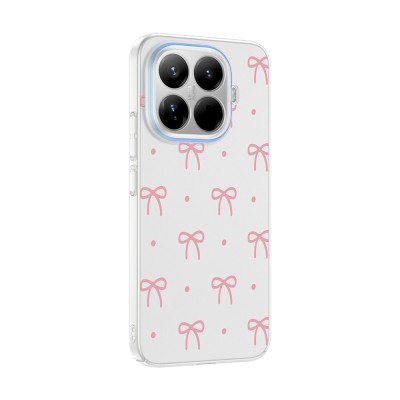 Xiaomi 15T Pro Case with Camera Protector, Patterned Zore Clip Cover - 7