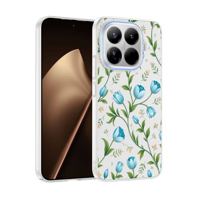 Xiaomi 15T Pro Case with Camera Protector, Patterned Zore Clip Cover - 4