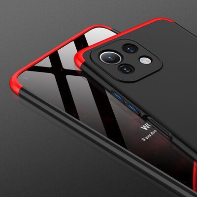 Xiaomi Mi 11 Lite Case Zore Ays Cover - 3