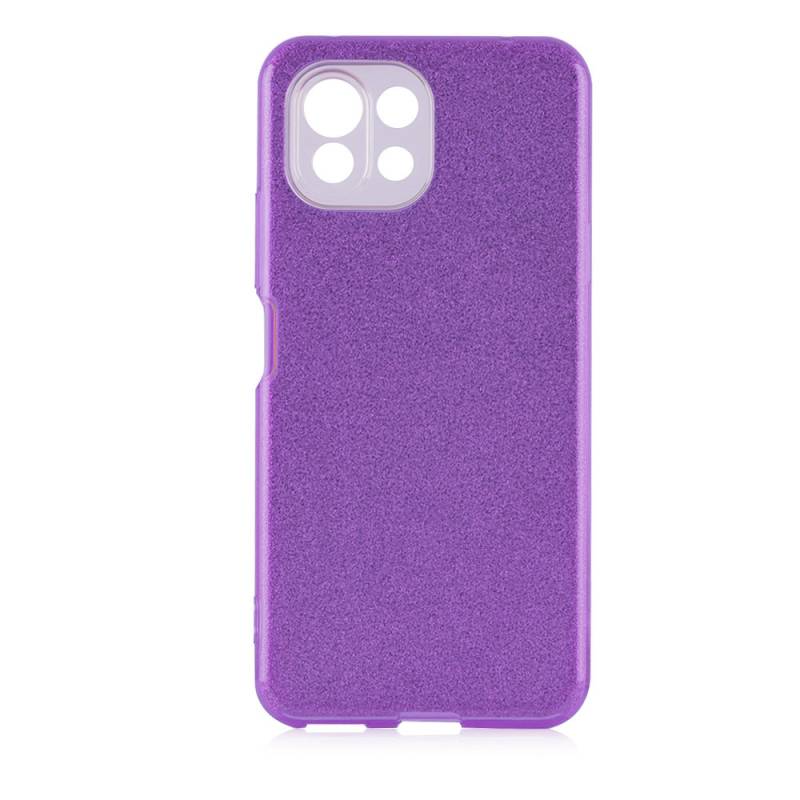 Xiaomi Mi 11 Lite Kılıf Zore Shining Silikon - 5