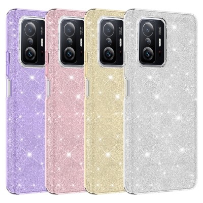 Xiaomi Mi 11T 5G Case Zore Shining Silicone - 2