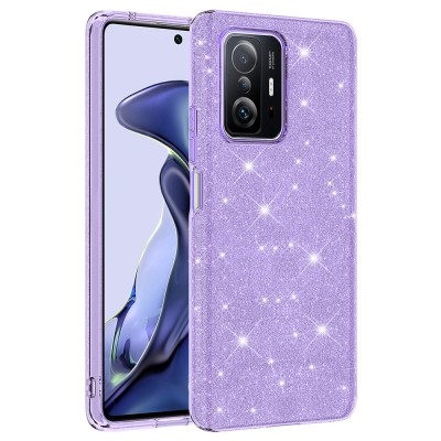 Xiaomi Mi 11T 5G Case Zore Shining Silicone - 3