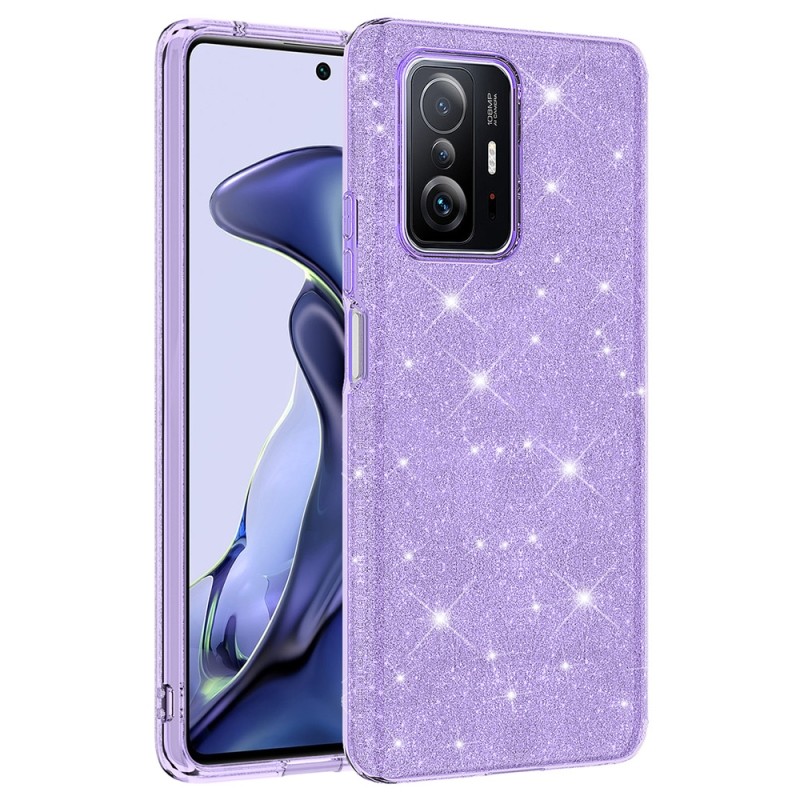 Xiaomi Mi 11T 5G Case Zore Shining Silicone - 3