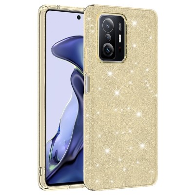 Xiaomi Mi 11T Pro 5G Case Zore Shining Silicone - 4