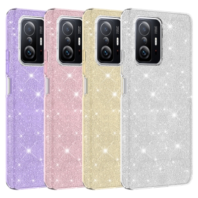 Xiaomi Mi 11T Pro 5G Kılıf Zore Shining Silikon - Thumbnail
