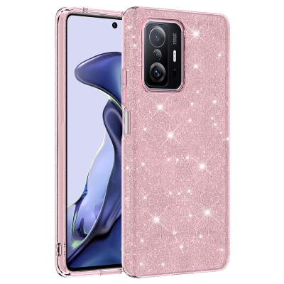 Xiaomi Mi 11T Pro 5G Kılıf Zore Shining Silikon - Thumbnail