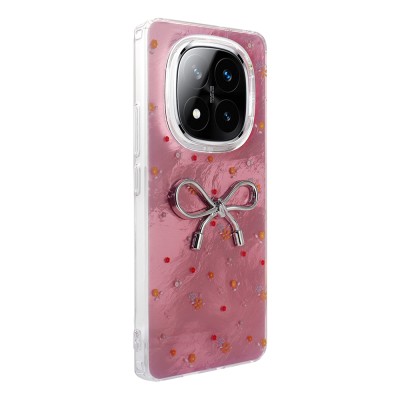 Xiaomi Poco X7 Case Camera Protection Figured Zore Ponti Silicone Cover - 8