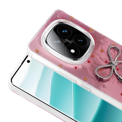 Xiaomi Poco X7 Case Camera Protection Figured Zore Ponti Silicone Cover - 9