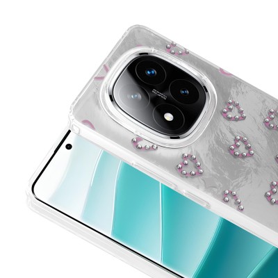 Xiaomi Poco X7 Case Camera Protection Figured Zore Ponti Silicone Cover - 13