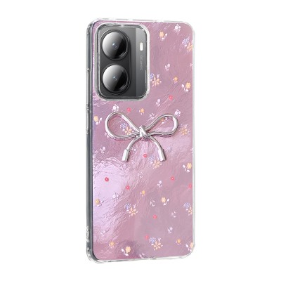 Xiaomi Poco X7 Pro Case Camera Protection Figured Zore Ponti Silicone Cover - 6