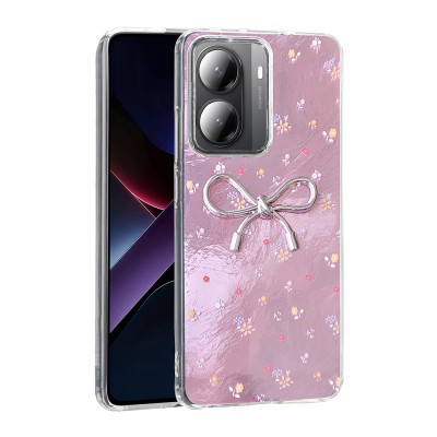 Xiaomi Poco X7 Pro Case Camera Protection Figured Zore Ponti Silicone Cover - 2