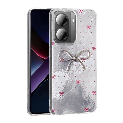 Xiaomi Poco X7 Pro Case Camera Protection Figured Zore Ponti Silicone Cover - 3