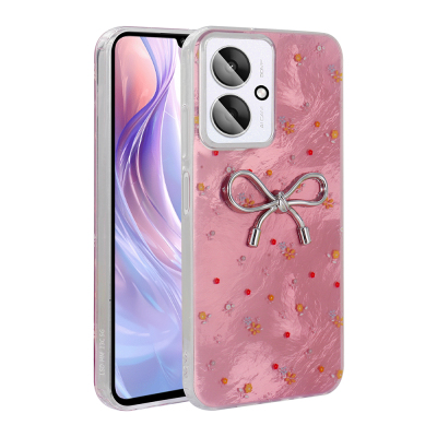 Xiaomi Redmi 13C Case Camera Protection Figured Zore Ponti Silicone Cover - Zore