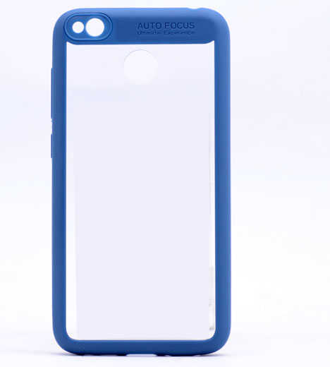 Xiaomi Redmi 4X Kılıf Zore Buttom Kapak - Mavi