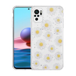 Xiaomi Redmi Note 10S Kılıf Simli Desenli Kamera Korumalı Parlak Zore Popy Kapak - 3