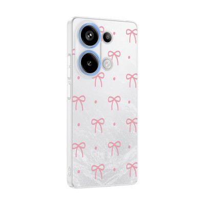 Xiaomi Redmi Note 13 Pro 4G Kılıf Kamera Korumalı Desenli Zore Klip Kapak - 7