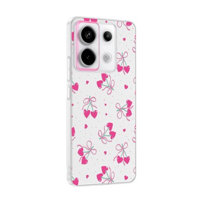 Xiaomi Redmi Note 13 Pro 5G Case with Camera Protector, Patterned Zore Clip Cover - 7